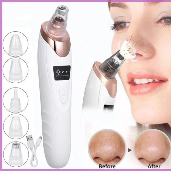 Blackhead Remover Pore Cleaner | Electric Deep Cleansing Tool for Nose & Face | USB Rechargeable with 4 Heads