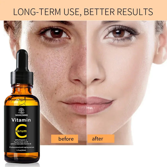 Natural Vitamin C Serum | Face Whitening, Brightening & Moisturizing | With Hyaluronic Acid – Made in USA